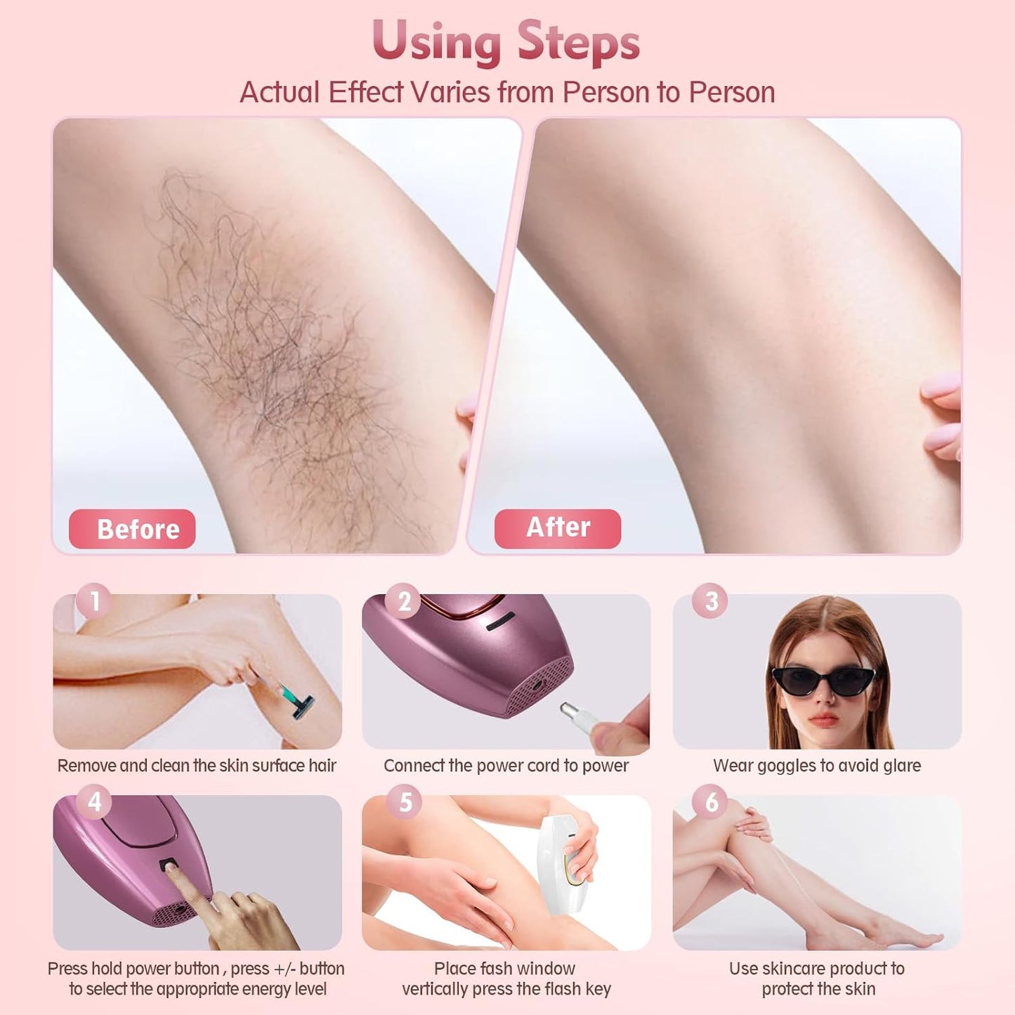 IPL Laser Hair Removal
